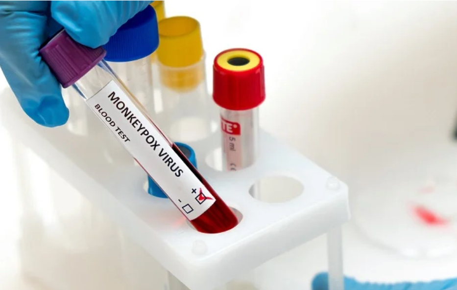 ANGOLA REGISTA DOIS NOVOS CASOS  DE Mpox